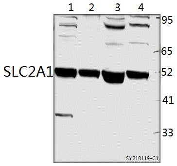 Western blot (WB) analysis of SLC2A1 polyclonal antibody at 1:500 dilution
Lane1:PC12 whole cell lysate(40ug)
Lane2:SGC7901 whole cell lysate(40ug)
Lane3:EC9706 whole cell lysate(40ug)
