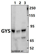 Western blot (WB) analysis of GYS (P539) polyclonal antibody at 1:500 dilution
Lane1:H1792 whole cell lysate(40ug)
Lane2:LO2 whole cell lysate(40ug)
Lane3:HEK293T whole cell lysate(40ug)