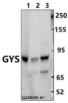 Western blot (WB) analysis of GYS (P539) polyclonal antibody at 1:500 dilution
Lane1:H1792 whole cell lysate(40ug)
Lane2:LO2 whole cell lysate(40ug)
Lane3:HEK293T whole cell lysate(40ug)