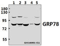 Western blot (WB) analysis of GRP78 (P641) polyclonal antibody at 1:500 dilution
Lane1:L02 whole cell lysate(40ug)
Lane2:HCT116 whole cell lysate(40ug)Lane3:HCT116 whole cell lysate(40ug)
Lane3:AML-12 whole cell lysate(40ug)
Lane4:PC12 whole cell lysate(40ug)Lane3:HCT116 whole cell lysate(40ug)
Lane5:HEK293T whole cell lysate(40ug)