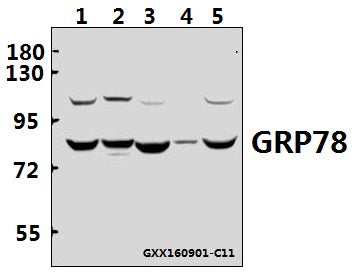 Western blot (WB) analysis of GRP78 (P641) polyclonal antibody at 1:500 dilution
Lane1:L02 whole cell lysate(40ug)
Lane2:HCT116 whole cell lysate(40ug)Lane3:HCT116 whole cell lysate(40ug)
Lane3:AML-12 whole cell lysate(40ug)
Lane4:PC12 whole cell lysate(40ug)Lane3:HCT116 whole cell lysate(40ug)
Lane5:HEK293T whole cell lysate(40ug)