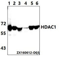 Western blot (WB) analysis of HDAC1 (E468) polyclonal antibody at 1:500 dillution
Lane1:HEK293T whole cell lysate(40μg)
Lane2:Hela whole cell lysate(40μg)
Lane3:The Kidney tissue lysate of Mouse(40μg)
Lane4:The Kidney tissue lysate of Rat(40μg)
Lane5:The Heart tissue lysate of Mouse(40μg)
Lane6:The Heart tissue lysate of Rat(40μg)