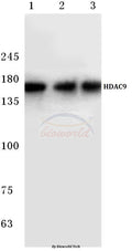 Western blot (WB) analysis of HDAC 9 (P1047) polyclonal antibody at 1:500 dilution
Lane1:LO2 cell lysate
Lane2:Mouse heart tissue lysate
Lane3:Rat heart tissue lysate