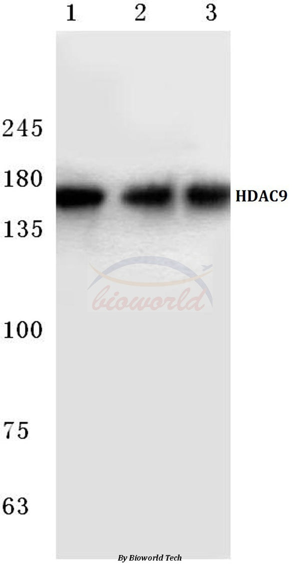 Western blot (WB) analysis of HDAC 9 (P1047) polyclonal antibody at 1:500 dilution
Lane1:LO2 cell lysate
Lane2:Mouse heart tissue lysate
Lane3:Rat heart tissue lysate