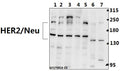 Western blot (WB) analysis of HER2/Neu (D871) polyclonal antibody at 1:500 dilution
Lane1:L02 whole cell lysate(40ug)
Lane2:A549 whole cell lysate(40ug)
Lane3:H1792 whole cell lysate(40ug)
Lane4:COS-7 whole cell lysate(40ug)
Lane5:HEK293T whole cell lysate(40ug)
Lane6:C6 whole cell lysate(40ug)
Lane7:SP2/0 whole cell lysate(40ug)
