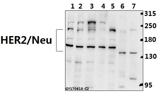 Western blot (WB) analysis of HER2/Neu (D871) polyclonal antibody at 1:500 dilution
Lane1:L02 whole cell lysate(40ug)
Lane2:A549 whole cell lysate(40ug)
Lane3:H1792 whole cell lysate(40ug)
Lane4:COS-7 whole cell lysate(40ug)
Lane5:HEK293T whole cell lysate(40ug)
Lane6:C6 whole cell lysate(40ug)
Lane7:SP2/0 whole cell lysate(40ug)