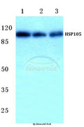 Western blot (WB) analysis of HSP105 (P819) polyclonal antibody at 1:500 dilution
Lane1:HEK293T cell lysate
Lane2:NIH-3T3 cell lysate
Lane3:PC12 cell lysate