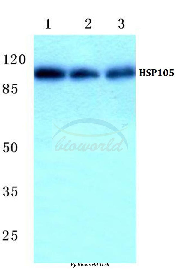 Western blot (WB) analysis of HSP105 (P819) polyclonal antibody at 1:500 dilution
Lane1:HEK293T cell lysate
Lane2:NIH-3T3 cell lysate
Lane3:PC12 cell lysate