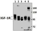 Western blot (WB) analysis of IGF-1R (G1155) pAb at 1:500 dilution
Lane1:AML-12 whole cell lysate(40ug)
Lane2:C6 whole cell lysate(40ug)
Lane3:HepG2 whole cell lysate(40ug)
Lane4:Panc1 whole cell lysate(40ug)
Lane5:HEK293T whole cell lysate(40ug)