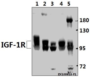 Western blot (WB) analysis of IGF-1R (G1155) pAb at 1:500 dilution
Lane1:AML-12 whole cell lysate(40ug)
Lane2:C6 whole cell lysate(40ug)
Lane3:HepG2 whole cell lysate(40ug)
Lane4:Panc1 whole cell lysate(40ug)
Lane5:HEK293T whole cell lysate(40ug)