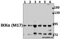 Western blot (WB) analysis of IKKα (M17) pAb at 1:500 dilution
Lane1:3T3-L1 whole cell lysate(40ug)
Lane2:C6 whole cell lysate(40ug)
Lane3:HEK293T whole cell lysate(40ug)
Lane4:L02 whole cell lysate(40ug)
Lane5:HepG2 whole cell lysate(40ug)
Lane6:HCT116 whole cell lysate(40ug)