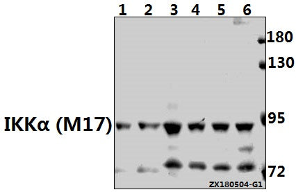 Western blot (WB) analysis of IKKα (M17) pAb at 1:500 dilution
Lane1:3T3-L1 whole cell lysate(40ug)
Lane2:C6 whole cell lysate(40ug)
Lane3:HEK293T whole cell lysate(40ug)
Lane4:L02 whole cell lysate(40ug)
Lane5:HepG2 whole cell lysate(40ug)
Lane6:HCT116 whole cell lysate(40ug)