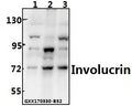 Western blot (WB) analysis ofInvolucrin (P568) polyclonal antibody at 1:500 dilution
Lane1:L02 whole cell lysate(40ug)
Lane2:A549 whole cell lysate(40ug)
Lane3:HepG2 whole cell lysate(40ug)