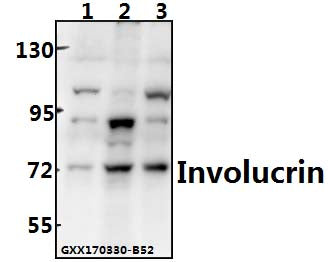 Western blot (WB) analysis ofInvolucrin (P568) polyclonal antibody at 1:500 dilution
Lane1:L02 whole cell lysate(40ug)
Lane2:A549 whole cell lysate(40ug)
Lane3:HepG2 whole cell lysate(40ug)