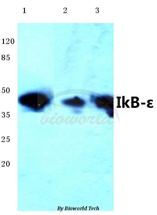 Western blot (WB) analysis of IkB-ε (D17) polyclonal antibody at 1:500 dilution
Lane1:HEK293T cell lysate
Lane2:NIH-3T3 cell lysate
Lane3:PC12 cell lysate