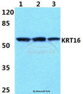 Western blot (WB) analysis of Cytokeratin 16 (S451) polyclonal antibody at 1:500 dilution
Lane1:MCF-7 cell lysate 
Lane2:sp2/0 cell lysate
Lane3:PC12 cell lysate