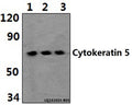 Western blot (WB) analysis of Cytokeratin 5 (S573) polyclonal antibody at 1:500 dilution
Lane1:HEK293T whole cell lysate(40ug)
Lane2:PC12 whole cell lysate(40ug)
Lane3:NIH-3T3 whole cell lysate(40ug)