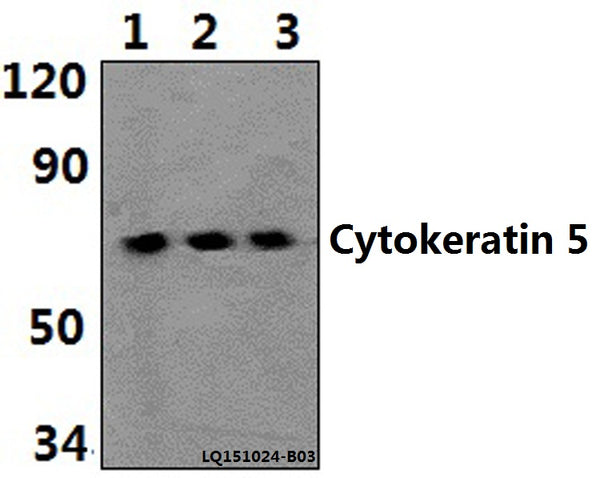 Western blot (WB) analysis of Cytokeratin 5 (S573) polyclonal antibody at 1:500 dilution
Lane1:HEK293T whole cell lysate(40ug)
Lane2:PC12 whole cell lysate(40ug)
Lane3:NIH-3T3 whole cell lysate(40ug)