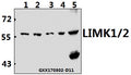 Western blot (WB) analysis of LIMK1/2 (D402) polyclonal antibody at 1:500 dilution
Lane1:HEK293T whole cell lysate(40ug)
Lane2:Panc1 whole cell lysate(40ug)
Lane3:A549 whole cell lysate(40ug)
Lane4:PC12 whole cell lysate(40ug)
Lane5:AML-12 whole cell lysate(40ug)