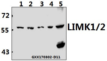 Western blot (WB) analysis of LIMK1/2 (D402) polyclonal antibody at 1:500 dilution
Lane1:HEK293T whole cell lysate(40ug)
Lane2:Panc1 whole cell lysate(40ug)
Lane3:A549 whole cell lysate(40ug)
Lane4:PC12 whole cell lysate(40ug)
Lane5:AML-12 whole cell lysate(40ug)