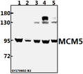 Western blot (WB) analysis of MCM5 (F51) polyclonal antibody at 1:500 dilution
Lane1:CT26 whole cell lysate(40ug)
Lane2:H9C2 whole cell lysate(40ug)
Lane3:A549 whole cell lysate(40ug)
Lane4:HEK293T whole cell lysate(40ug)
Lane5:MCF-7 whole cell lysate(40ug)