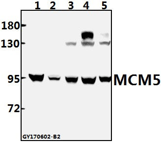 Western blot (WB) analysis of MCM5 (F51) polyclonal antibody at 1:500 dilution
Lane1:CT26 whole cell lysate(40ug)
Lane2:H9C2 whole cell lysate(40ug)
Lane3:A549 whole cell lysate(40ug)
Lane4:HEK293T whole cell lysate(40ug)
Lane5:MCF-7 whole cell lysate(40ug)