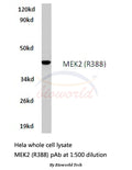 Western blot (WB) analysis of MEK2 (R388) polyclonal antibody in extracts from hela cells.