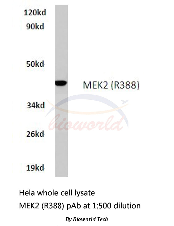 Western blot (WB) analysis of MEK2 (R388) polyclonal antibody in extracts from hela cells.