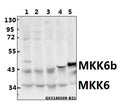 Western blot (WB) analysis of MEK-6 (S201) polyclonal antibody at 1:500 dilution
Lane1:L02 whole cell lysate(40ug)
Lane2:Panc1 whole cell lysate(40ug)
Lane3:CT26 whole cell lysate(40ug)
Lane4:The Heart tissue lysate of Rat(40ug)
Lane5:The Muscle tissue lysate of Mouse(40ug)