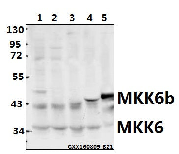 Western blot (WB) analysis of MEK-6 (S201) polyclonal antibody at 1:500 dilution
Lane1:L02 whole cell lysate(40ug)
Lane2:Panc1 whole cell lysate(40ug)
Lane3:CT26 whole cell lysate(40ug)
Lane4:The Heart tissue lysate of Rat(40ug)
Lane5:The Muscle tissue lysate of Mouse(40ug)
