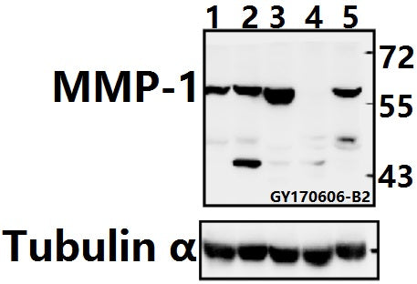 Western blot (WB) analysis of MMP-1 (H440) pAb at 1:500 dilution
Lane1:L02 whole cell lysate(40ug)
Lane2:MCF-7 whole cell lysate(40ug)
Lane3:CT26 whole cell lysate(40ug)
Lane4:H9C2 whole cell lysate(40ug)
Lane5:HepG2 whole cell lysate(40ug)