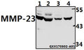 Western blot (WB) analysis of MMP-23 (V371) polyclonal antibody at 1:500 dilution
Lane1:BV2 whole cell lysate(40ug)
Lane2:H9C2 whole cell lysate(40ug)
Lane3:PC3 whole cell lysate(40ug)
Lane4:SK-OVCAR3 whole cell lysate(40ug)