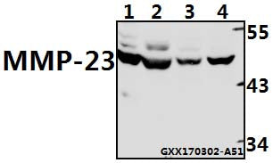 Western blot (WB) analysis of MMP-23 (V371) polyclonal antibody at 1:500 dilution
Lane1:BV2 whole cell lysate(40ug)
Lane2:H9C2 whole cell lysate(40ug)
Lane3:PC3 whole cell lysate(40ug)
Lane4:SK-OVCAR3 whole cell lysate(40ug)