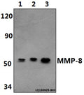 MMP-8 (F445) polyclonal antibody – Figure 1 of 1