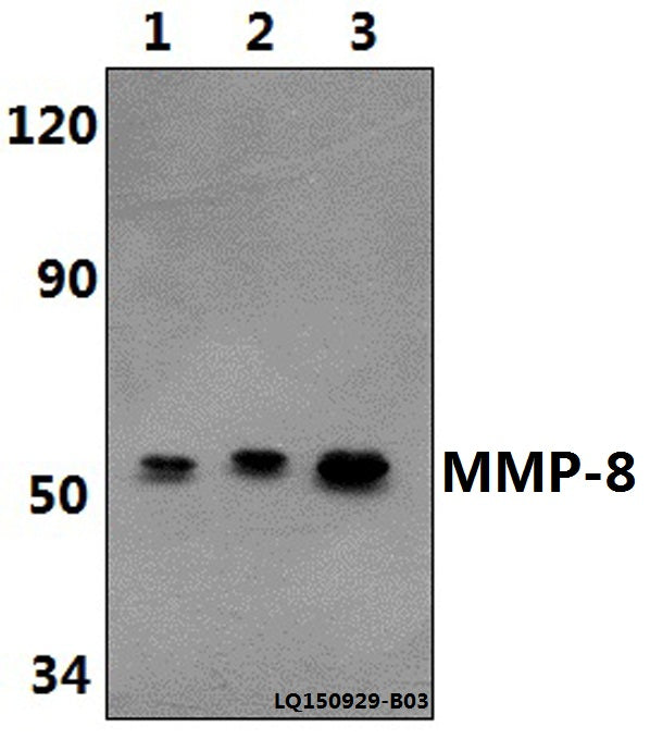 MMP-8 (F445) polyclonal antibody – Figure 1 of 1