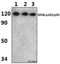 Western blot (WB) analysis of NFkB-p105/p50 (Q332) polyclonal antibody at 1:1000 dilution
Lane1:HEK293T whole cell lysate(45ug)
Lane2:RAW264.7 whole cell lysate(46ug)
Lane3:H9C2 whole cell lysate(37ug)
Lane4:HepG2 whole cell lysate(46ug)