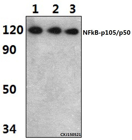 Western blot (WB) analysis of NFkB-p105/p50 (Q332) polyclonal antibody at 1:1000 dilution
Lane1:HEK293T whole cell lysate(45ug)
Lane2:RAW264.7 whole cell lysate(46ug)
Lane3:H9C2 whole cell lysate(37ug)
Lane4:HepG2 whole cell lysate(46ug)