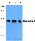 Dynactin 2 (L371) polyclonal antibody – Figure 1 of 1