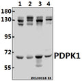 Western blot (WB) analysis of PDPK1 (K235) Antibody at 1:1000 dilution
Lane1:MCF-7 whole cell lysate(40ug)
Lane2:A549 whole cell lysate(40ug)
Lane3:PC12 whole cell lysate(40ug)
Lane4:3T3-L1 whole cell lysate(40ug)