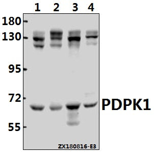 Western blot (WB) analysis of PDPK1 (K235) Antibody at 1:1000 dilution
Lane1:MCF-7 whole cell lysate(40ug)
Lane2:A549 whole cell lysate(40ug)
Lane3:PC12 whole cell lysate(40ug)
Lane4:3T3-L1 whole cell lysate(40ug)