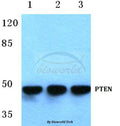 Western blot (WB) analysis of PTEN (S364) polyclonal antibody at 1:500 dilution
Lane1:HEK293T cell lysate
Lane2:Mouse spleen tissue lysate
Lane3:Rat spleen tissue lysate