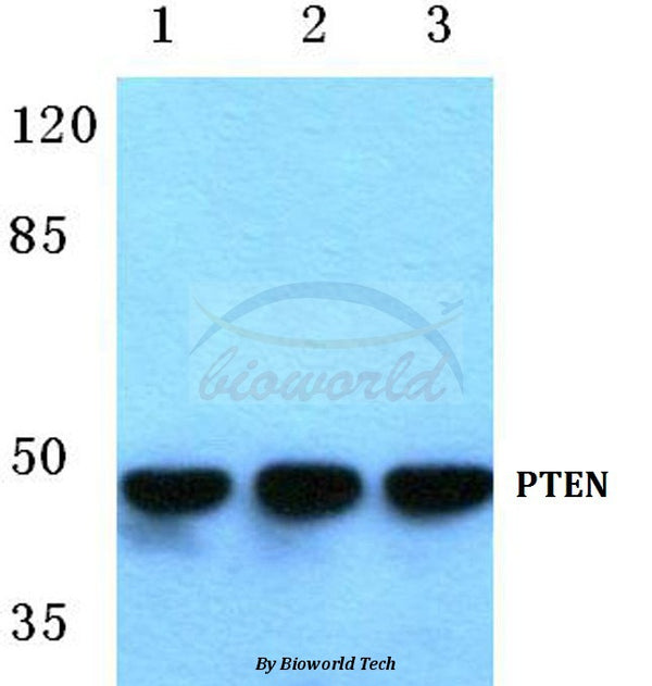 Western blot (WB) analysis of PTEN (S364) polyclonal antibody at 1:500 dilution
Lane1:HEK293T cell lysate
Lane2:Mouse spleen tissue lysate
Lane3:Rat spleen tissue lysate