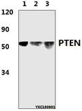Western blot (WB) analysis of PTEN (D375) polyclonal antibody at 1:500 dillution
Lane1:HeLa whole cell lysate(50μg)
Lane2:PC12 whole cell lysate(50μg)
Lane3:RAW264.7 whole cell lysate(50μg)