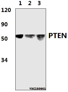 Western blot (WB) analysis of PTEN (D375) polyclonal antibody at 1:500 dillution
Lane1:HeLa whole cell lysate(50μg)
Lane2:PC12 whole cell lysate(50μg)
Lane3:RAW264.7 whole cell lysate(50μg)