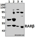 Western blot (WB) analysis of RARβ (L359) pAb at 1:500 dilution
Lane1:SK-OVCAR3 whole cell lysate(40ug)
Lane2:MCF-7 whole cell lysate(40ug)
Lane3:C6 whole cell lysate(40ug)
Lane4:CT26 whole cell lysate(40ug)