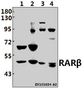 Western blot (WB) analysis of RARβ (L359) pAb at 1:500 dilution
Lane1:SK-OVCAR3 whole cell lysate(40ug)
Lane2:MCF-7 whole cell lysate(40ug)
Lane3:C6 whole cell lysate(40ug)
Lane4:CT26 whole cell lysate(40ug)