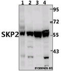 Western blot (WB) analysis of SKP2 at 1:500 dilution
Lane1:EC9706 whole cell lysate(40ug)
Lane2:HepG2 whole cell lysate(40ug)
Lane3:U-87MG whole cell lysate(40ug)
Lane4:A375 whole cell lysate(40ug)