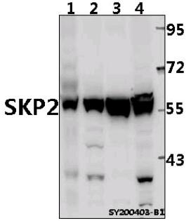 Western blot (WB) analysis of SKP2 at 1:500 dilution
Lane1:EC9706 whole cell lysate(40ug)
Lane2:HepG2 whole cell lysate(40ug)
Lane3:U-87MG whole cell lysate(40ug)
Lane4:A375 whole cell lysate(40ug)