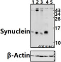 Western blot (WB) analysis of Synuclein (A19) pAb at 1:500 dilution
Lane1:Panc1 whole cell lysate(40ug)
Lane2:HEK293T whole cell lysate(40ug)
Lane3:A549 whole cell lysate(40ug)
Lane4:The Brain tissue lysate of Mouse(40ug)
Lane5:The Brain tissue lysate of Rat(40ug)