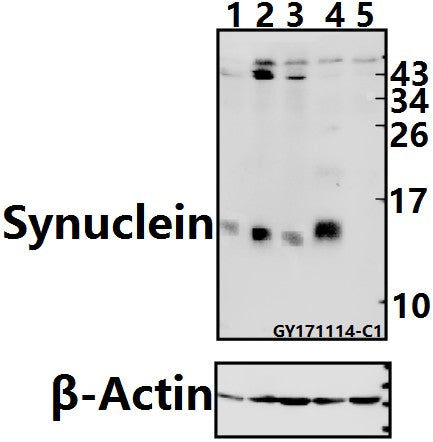 Western blot (WB) analysis of Synuclein (A19) pAb at 1:500 dilution
Lane1:Panc1 whole cell lysate(40ug)
Lane2:HEK293T whole cell lysate(40ug)
Lane3:A549 whole cell lysate(40ug)
Lane4:The Brain tissue lysate of Mouse(40ug)
Lane5:The Brain tissue lysate of Rat(40ug)